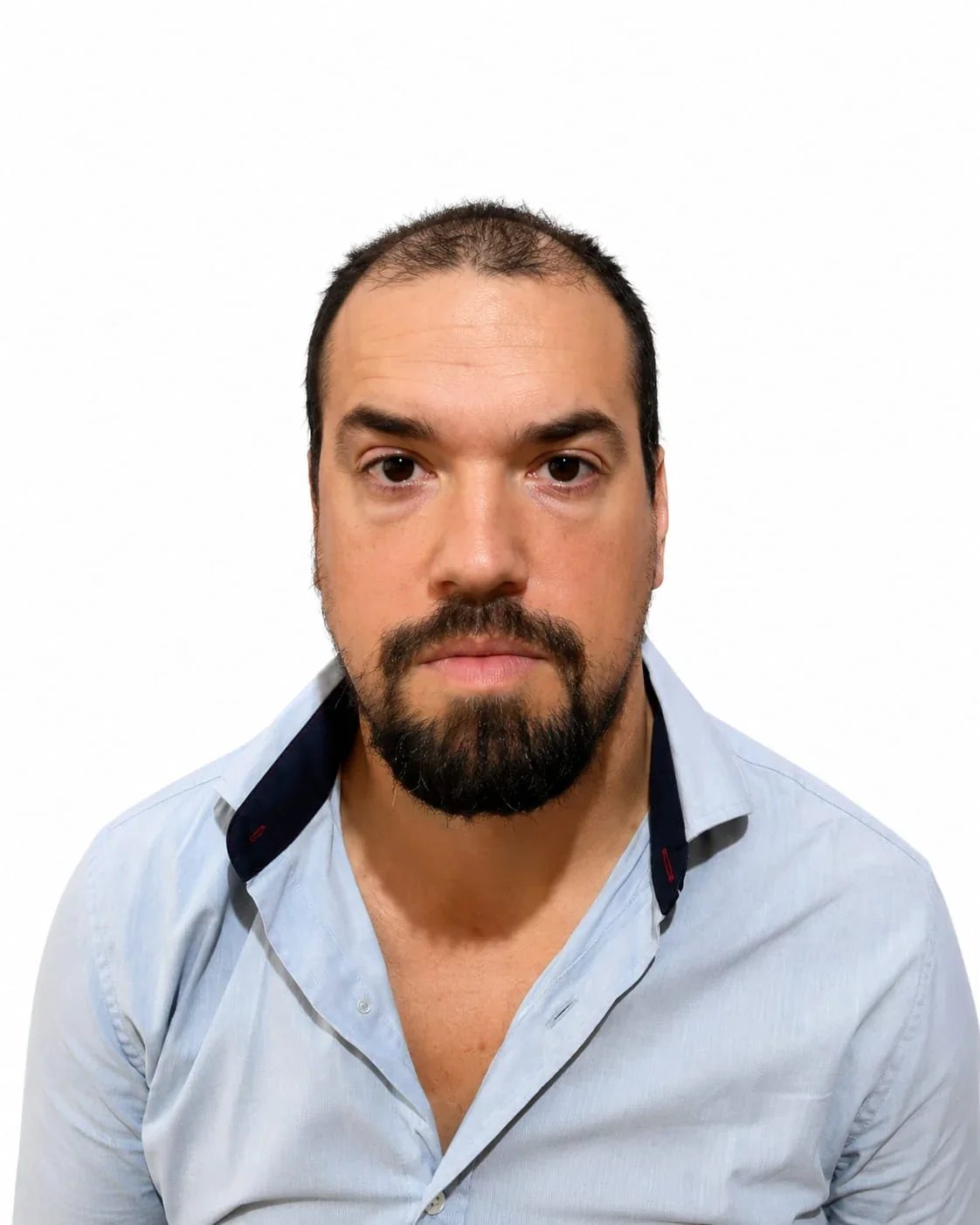 Matías García Giachino · Antes · vista frontal adicional
